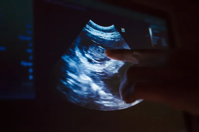 gambar ultrasound